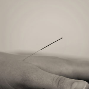 Qu'est-ce que l'acupuncture?